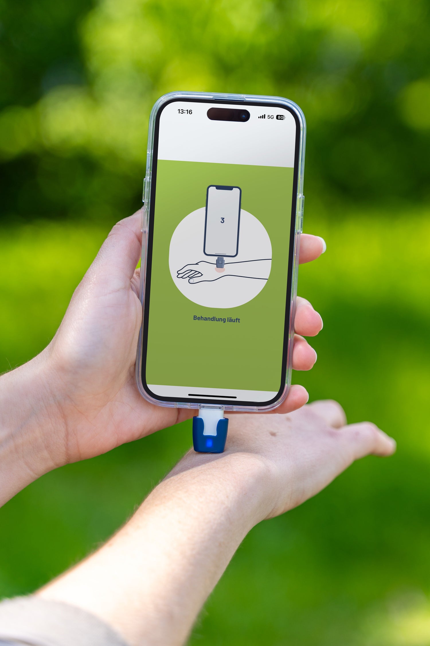 독일에서 온 모기가려움 솔루션! 히트잇 heat it 을 소개합니다!